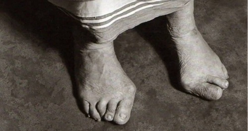 Kembet e Nene Terezes1